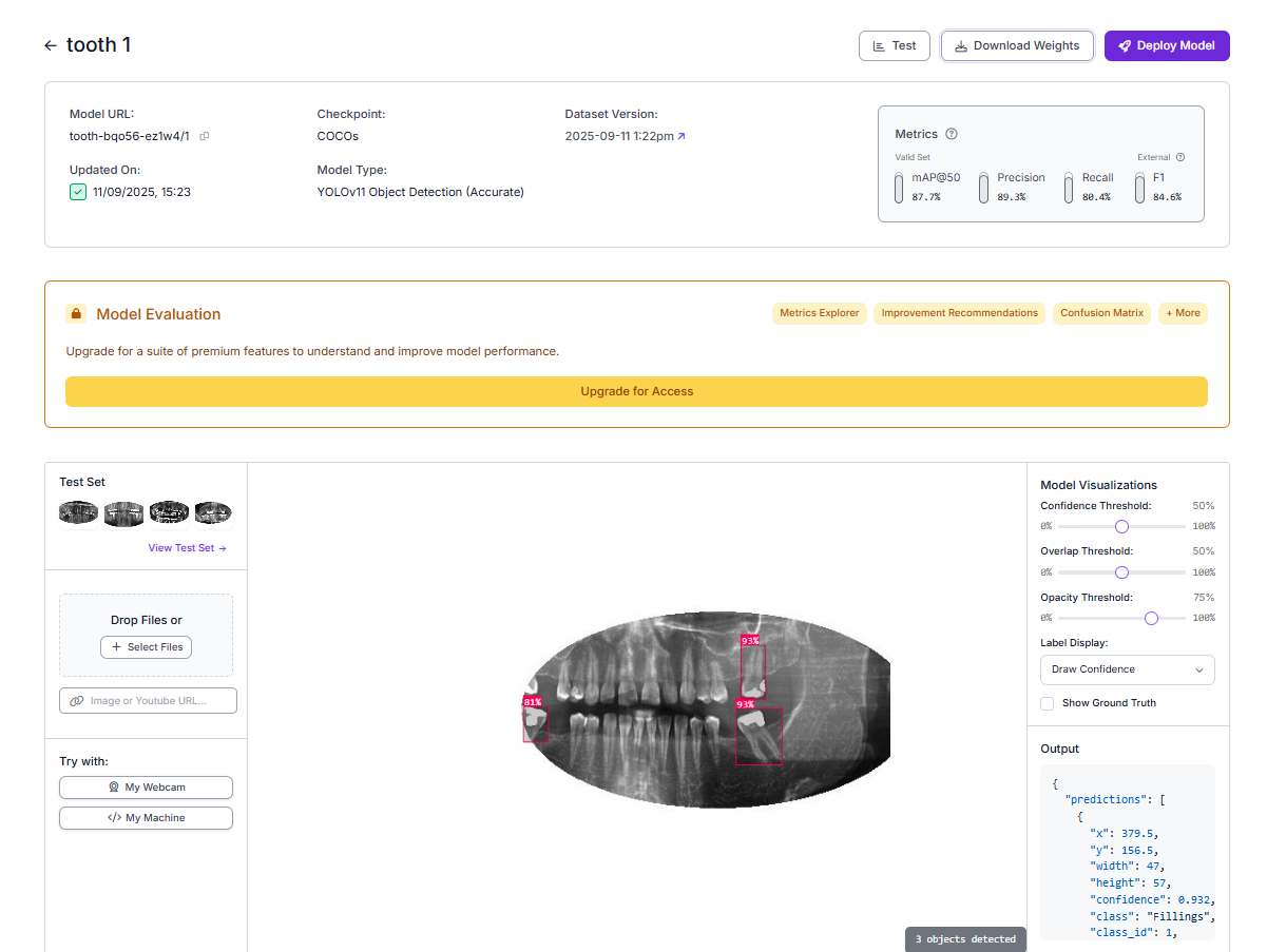 Tooth fine-tuning parameters
