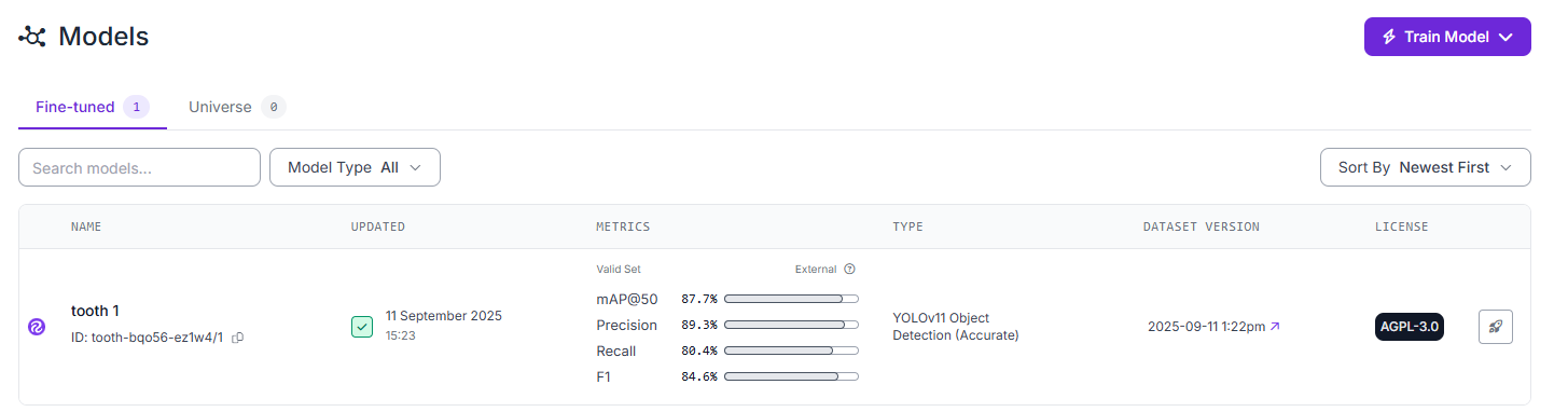 Roboflow tooth 1 fine-tuned model dashboard