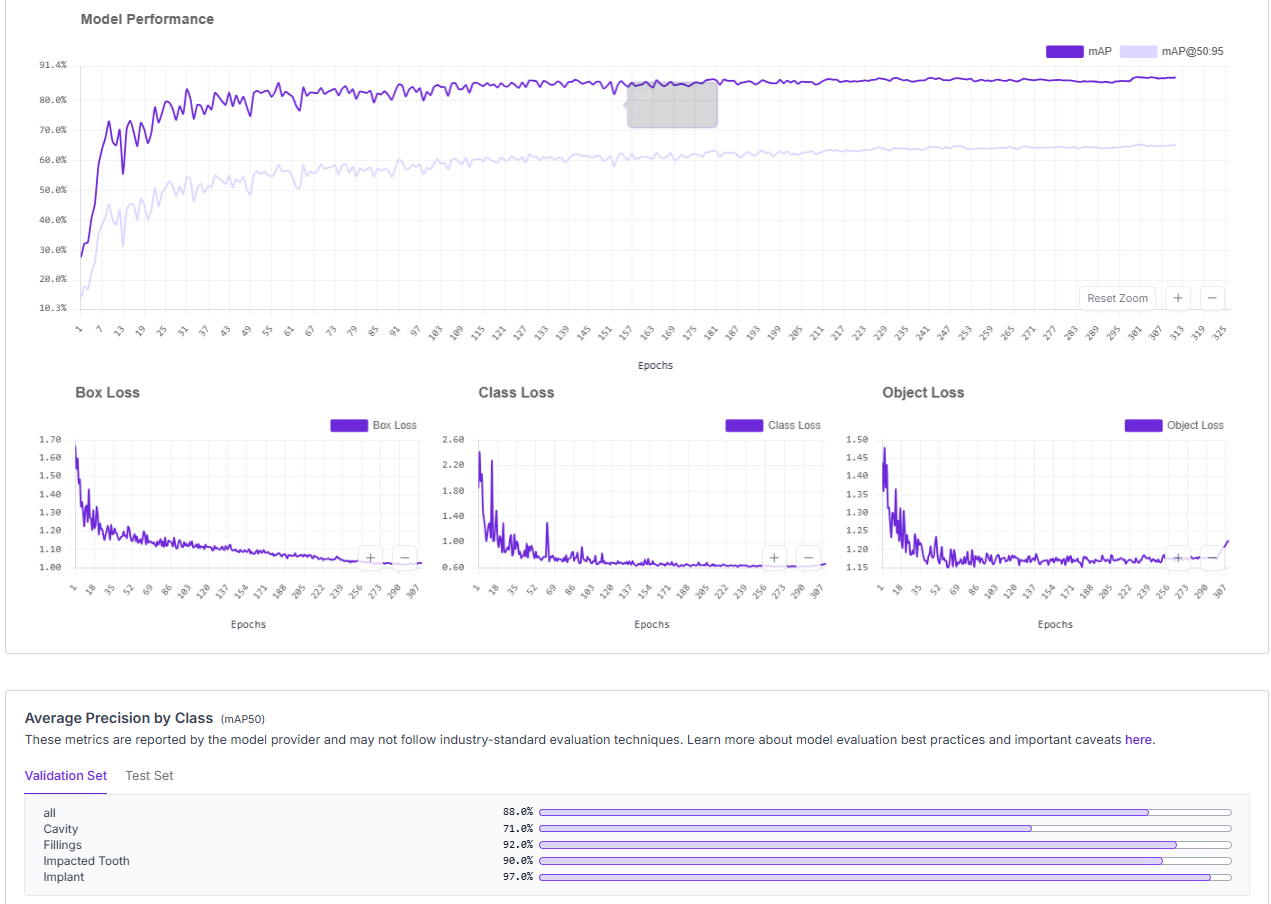 Tooth model mAP loss curves and per-class AP
